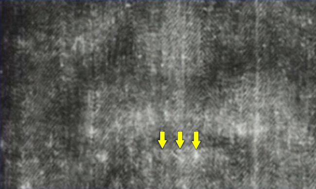Evidence of an X-Ray Effect?