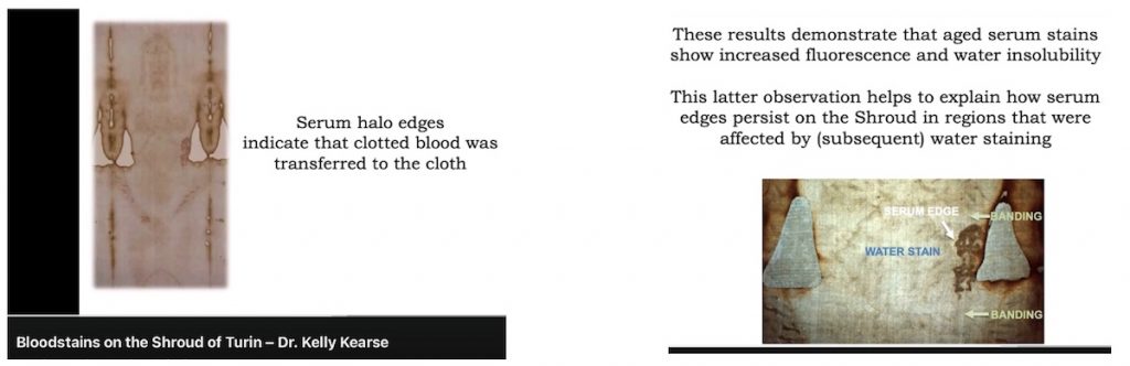 Blood Transfer a Gamechanger
