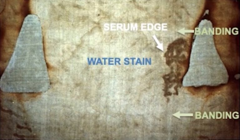 Turin Shroud Blood and Serum